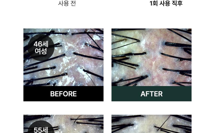 오드프리 딥클린 스칼프 샴푸 상세페이지