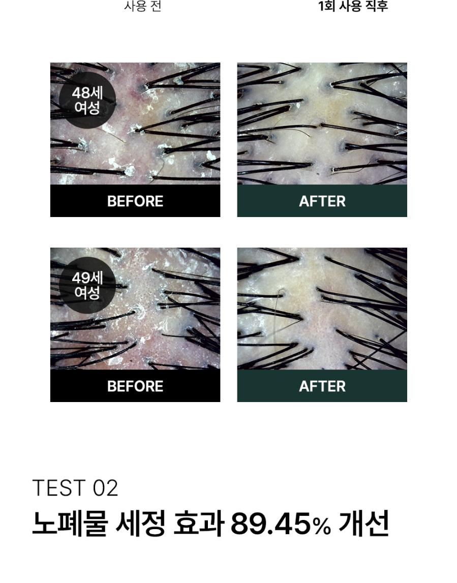 오드프리 딥클린 스칼프 샴푸 상세페이지